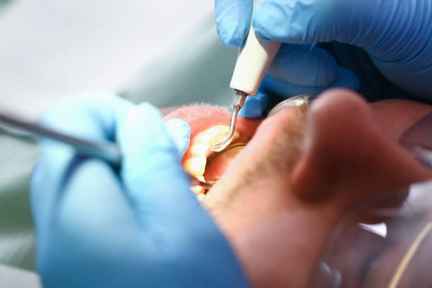 Best Emergency Tooth Extraction in Brownlee Park, MI