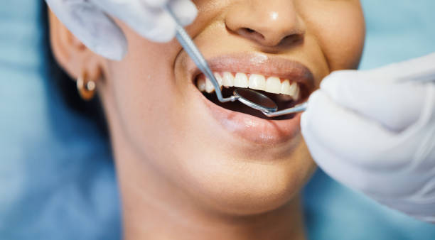 Best Emergency Root Canal Treatment in Brownlee Park, MI