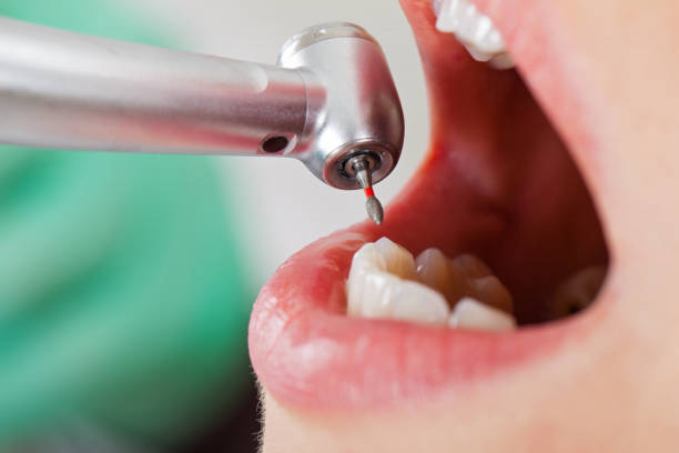Best Emergency Tooth Extraction in Brownlee Park, MI